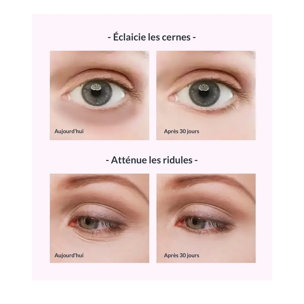 Innovation : Dites adieu aux regard fatigué
